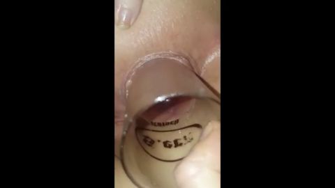 berlin-couple - Glas im Arsch [SD 480P]